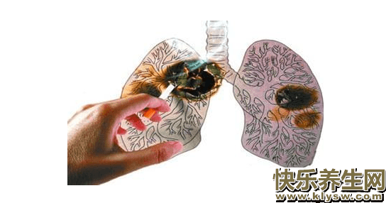 肺癌患者晚期临终过程