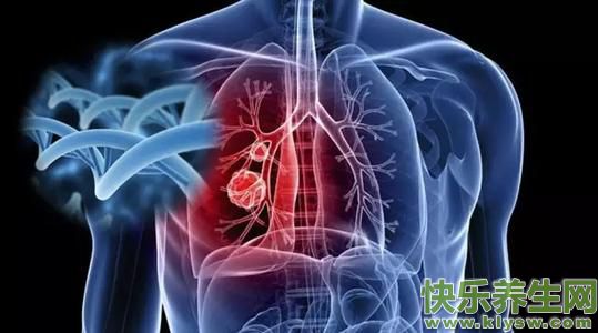 肺癌能活多久？